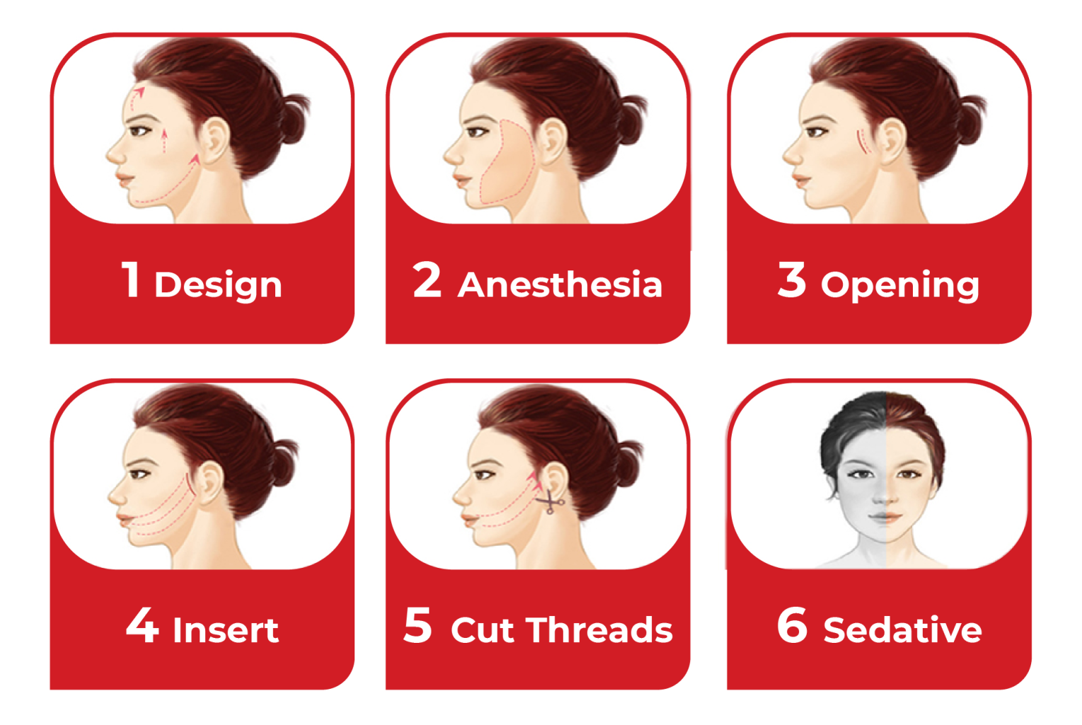 Lifting Threads AVENTA
