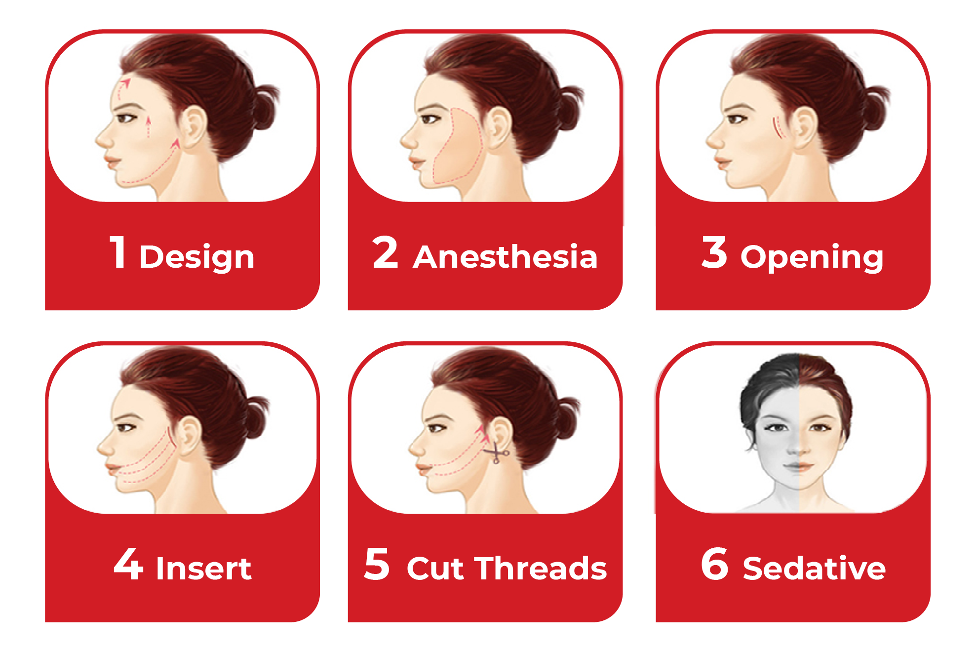 Lifting Threads AVENTA